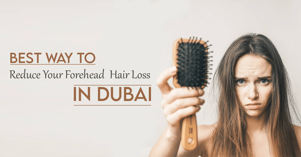 Best Way to Reduce Your Forehead Hair Loss In Dubai
