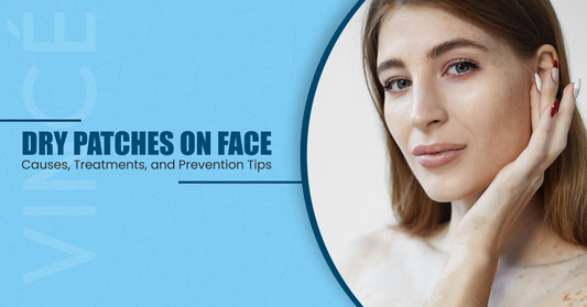 Dry Patches on Face Causes, Treatments, and Prevention Tips