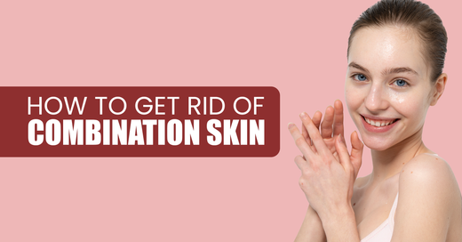How to Get Rid of Combination Skin