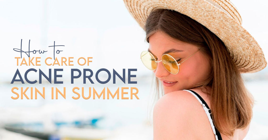How to Take Care of Acne Prone Skin in Summer