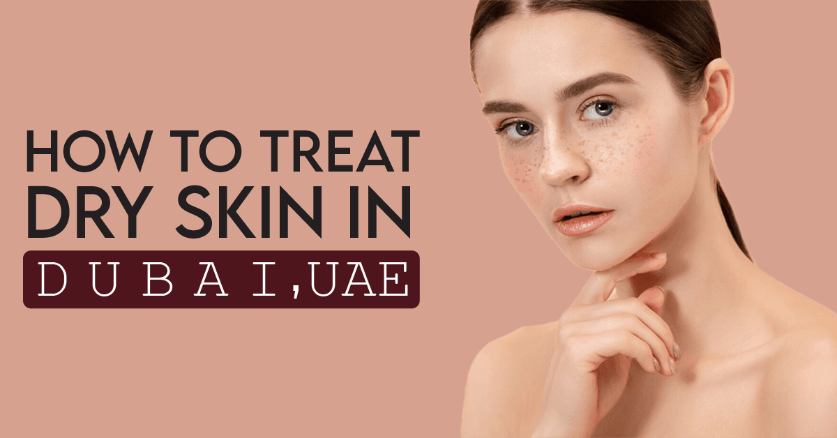 How To Treat Dry Skin in UAE Vince Beauty