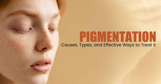 Pigmentation Causes, Types, and Effective Ways to Treat It