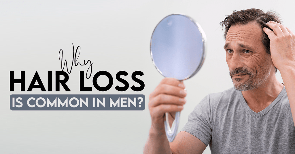 Why Hair Loss Is Common In Men?