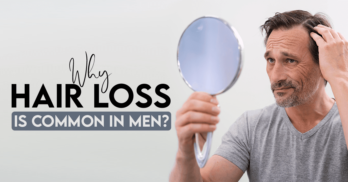 Why Hair Loss Is Common In Men? | Causes of Hair Loss In Men – Vince Beauty