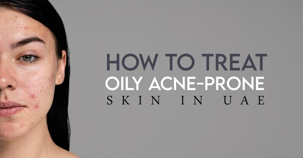 How To Effectively Treat Oily Acne Prone Skin in UAE
