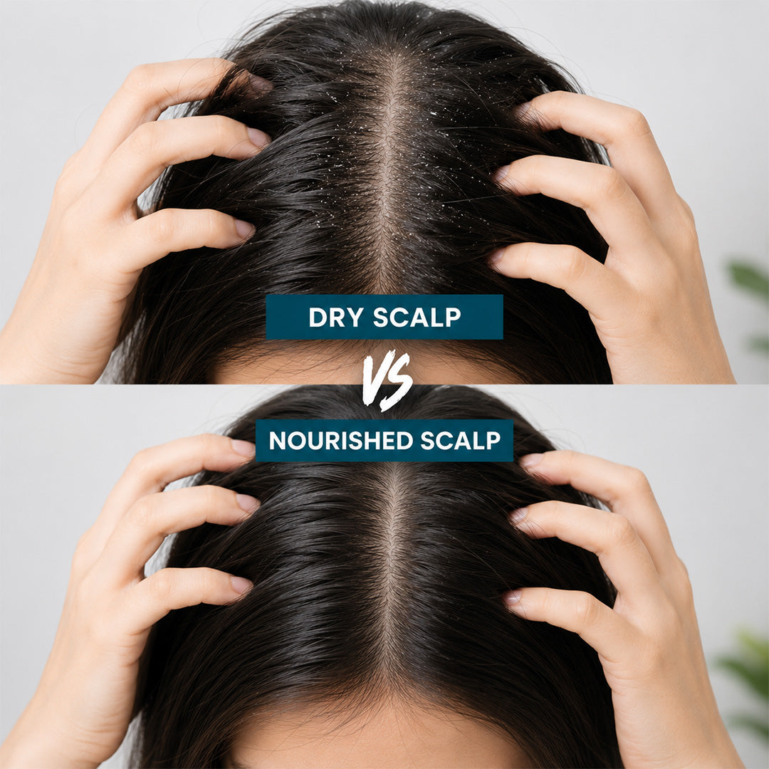 Before_After_Scalp_Xpert_Anti_Dandruff_Shampoo