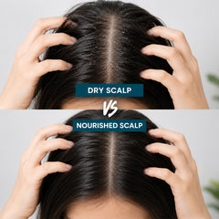 Before_After_Scalp_Xpert_Anti_Dandruff_Shampoo